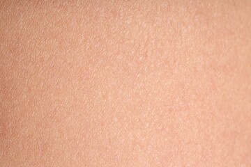 Texture of normal skin as background, closeup