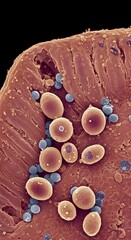 A microscopic view of Cryptosporidium parasite, showing its oval shape with surface details, set against a blurred background.