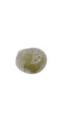 foamy urine