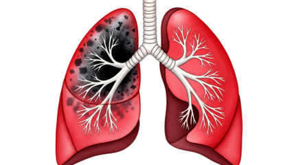 Illustration of diseased lungs with black spots isolated on transparent background