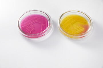 Microbiology Laboratory. Petri Dishes with Various Bacteria Samples