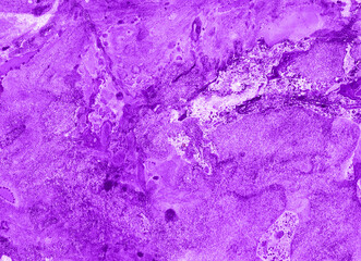Abstract purple textured background with marbled artistic pattern. Spots, drops, splashes, blurs of various forms. Bright contemporary design for print, wallpaper, or creative projects.