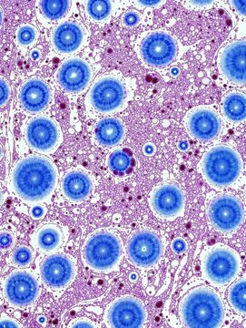 Lassa virus laboratory visualization of infected tissue with necrotic lesions and vacuolization