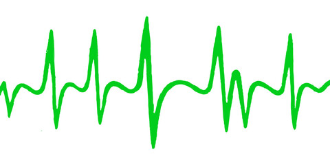 Medical illustration of a heartbeat pulse graph or EKG line on a green monitor, representing health and technology