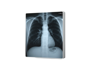 Chest X-ray view within a light box, revealing the bones and internal organs