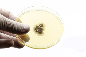 Laboratory plate with a fungus. Fungal infections.