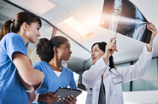 Doctor, nurses and tablet with xray analysis for treatment planning, assess bone alignment or injury. Teamwork, women and pointing to knee scan for results evaluation, medical opinion and low angle