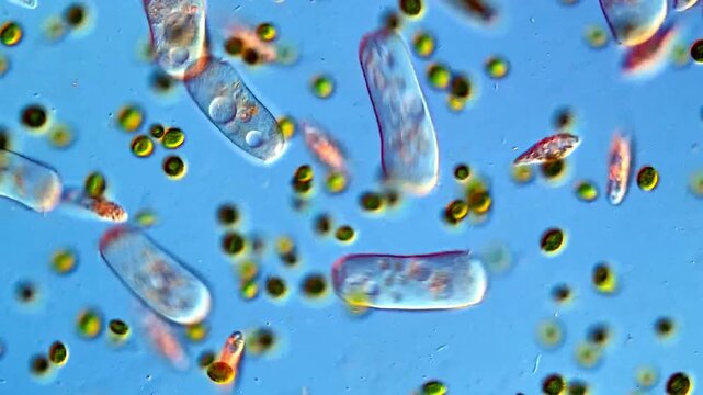 Microscope view of protozoa and green algae, 200x