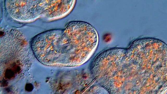 Movement of freshwater protozoa, DIC microscope 400x 