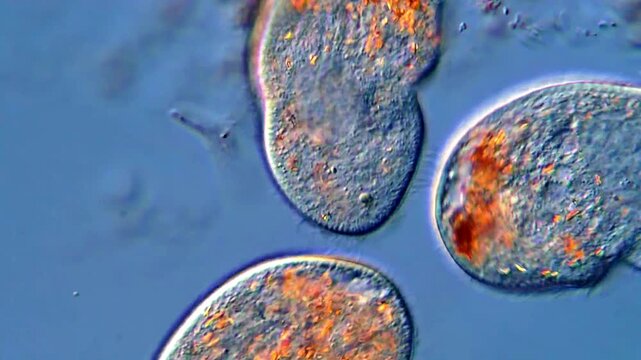 Ciliates protozoa, microscope view 400x magnification 