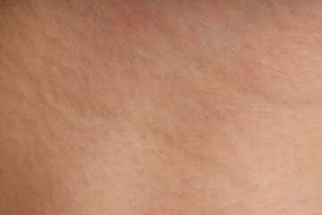 Fototapeta premium Human skin, closeup view. Detailed texture of surface