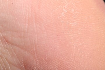 Fototapeta premium Macro view of dry human skin with wrinkles as background