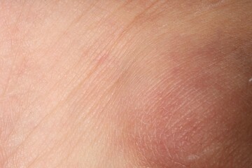 Macro view of human skin as background