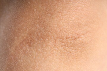 Texture of normal skin as background, closeup