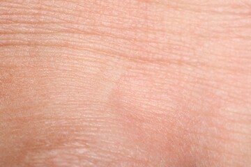 Fototapeta premium Macro view of human skin with wrinkles as background