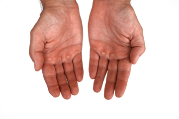 Close-up of male hands with calluses on palms, isolated on transparent background. Concept of hard work, manual labor, rough skin, strength, effort, and perseverance. PNG file.