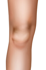 Realistic medical illustration of a human knee joint, isolated on a white background. The image shows the anatomical structure of the knee area