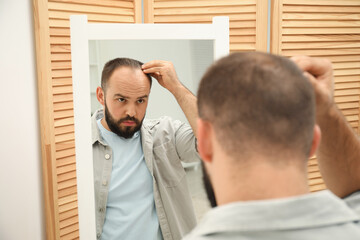 Fototapeta premium Baldness problem. Man with receding hairline near mirror at home
