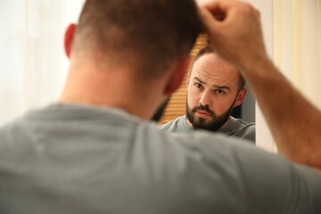 Baldness problem. Man with receding hairline near mirror at home