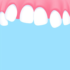 Upper teeth (Crooked) - Text box banner (square) illustration vector design. Dental care concept.