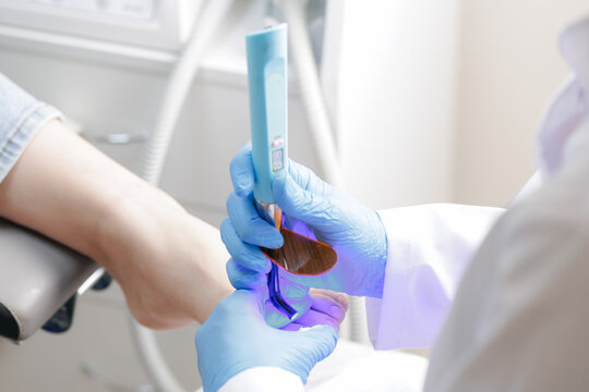 Podiatrist use UV for secures brace titanium thread on toenail for treatment ingrown nail of women, pedicure treatment on white background