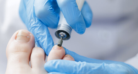 Care pedicure banner on white background. Process Podiatrist treating patient foot woman