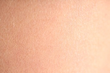Texture of normal skin as background, closeup