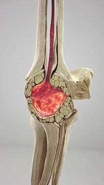 Long Bone Cross Section with Compact and Red Marrow