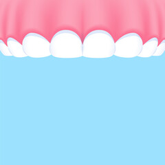 Upper teeth (Gummy Smile) - Text box banner (square) illustration vector design. Dental care concept.