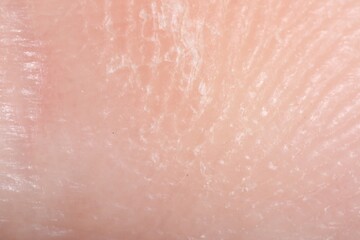 Macro view of dry human skin as background