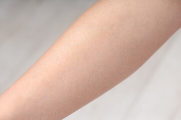 Woman with normal skin on blurred background, closeup