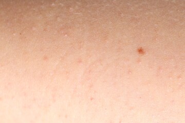 Fototapeta premium Texture of normal skin as background, closeup