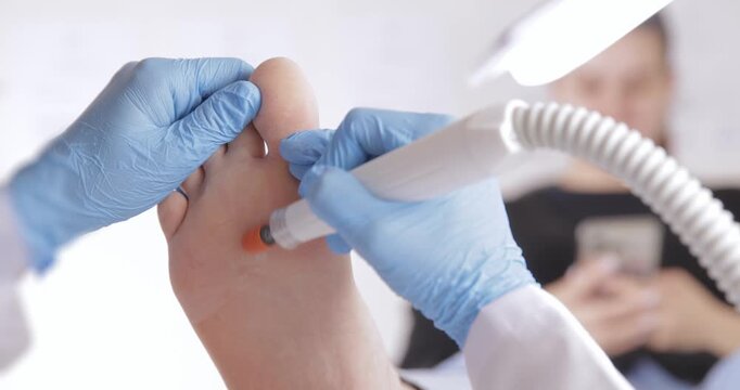 Podiatrist treating feet with tool in clinic visit, toenails pedicure and callus polish.