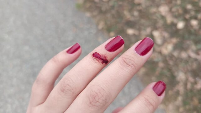 Blood flows from the wound down the woman's finger. The woman cut herself with sharp glass. Wound, finger injury