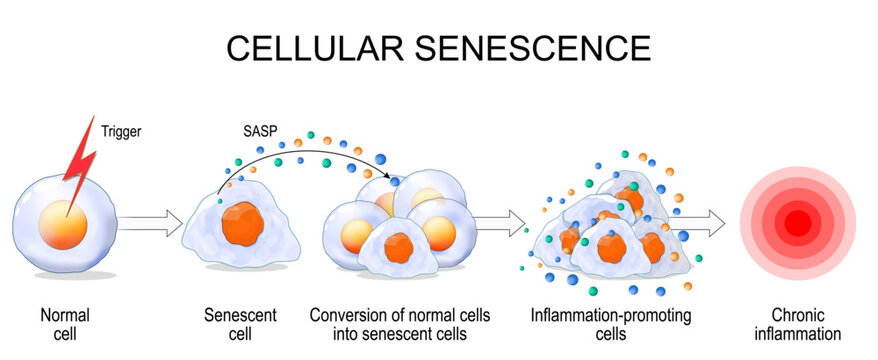 Cellular senescence. Chronic inflammation