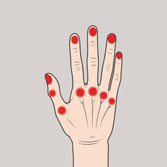 Flat Solid Color Vector for World Arthritis Day Showing Joint Pain, Mobility Exercises, Awareness Ribbon, Medical Infographic Style, Promoting Arthritis Care and Health Education