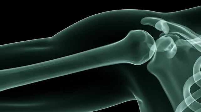 Shoulder X-Ray Scan: Medical Visualization of Bone Structure and Anatomy