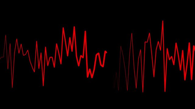 Heartbeat waves showing 3 conditions: tachycardia, healthy heartbeat and loose of heartbeat. Loopable. Electrocardiogram heart rate on the screen of medical equipment 4k video.