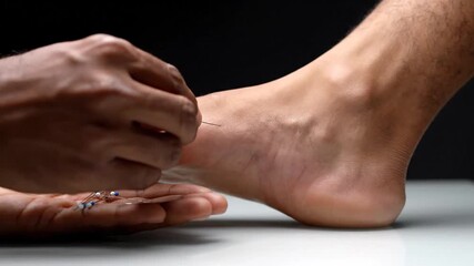 Close Up Focus on Human Foot with Thread Insertion on White Surface Against Dark Background for Educational Purposes Detailing Human Anatomy and Muscular Structure Highlighting Health