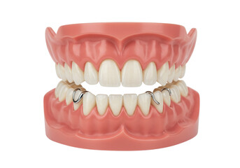 Dental model with partial denture isolated, anatomical representation of human teeth and gums for educational purposes and dental prosthetics