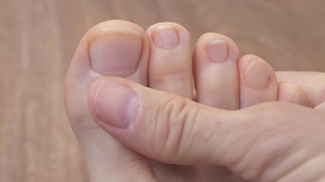 Stroking fingers. Man massages his foot and fingers. Self-massage of foot and toes. Acupressure. Beautiful ideal male foot with uncut nails. Feet and toes of an adult man, close-up shot