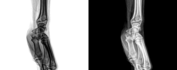 Lateral View Wrist X-Ray Radiograph Showing Skeletal Anatomy and Bone Alignment for Fracture Diagnosis Isolated on a Transparent Background