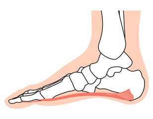 足底筋膜　足底腱膜　足底筋膜炎　足の筋肉