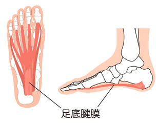 足底筋膜　足底腱膜　足底筋膜炎　足の筋肉