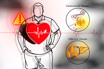 Medical illustration concept showing the link between obesity, cardiovascular disease, and fatty liver disease. The red heart with ECG line symbolizes heart risk.
