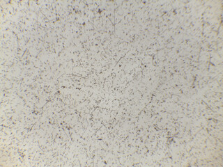 Microscopic View of Freshwater Diatoms