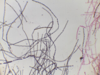 Sphaeroplea and Other Algae Filaments