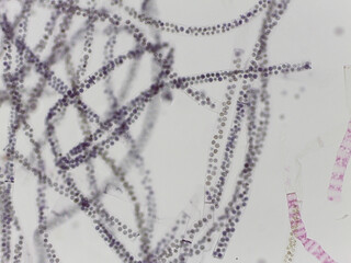 Sphaeroplea and Other Algae Filaments