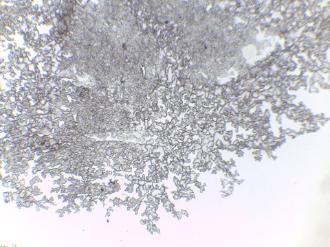Anabaena Filaments and Heterocysts