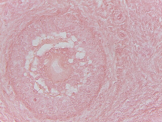 Fototapeta premium Human Ovary with Follicles under the Microscop